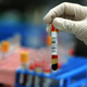 Thousands of patients at a New Jersey surgical center will need blood tests to ensure they weren’t exposed to dangerous bloodborne diseases like HIV